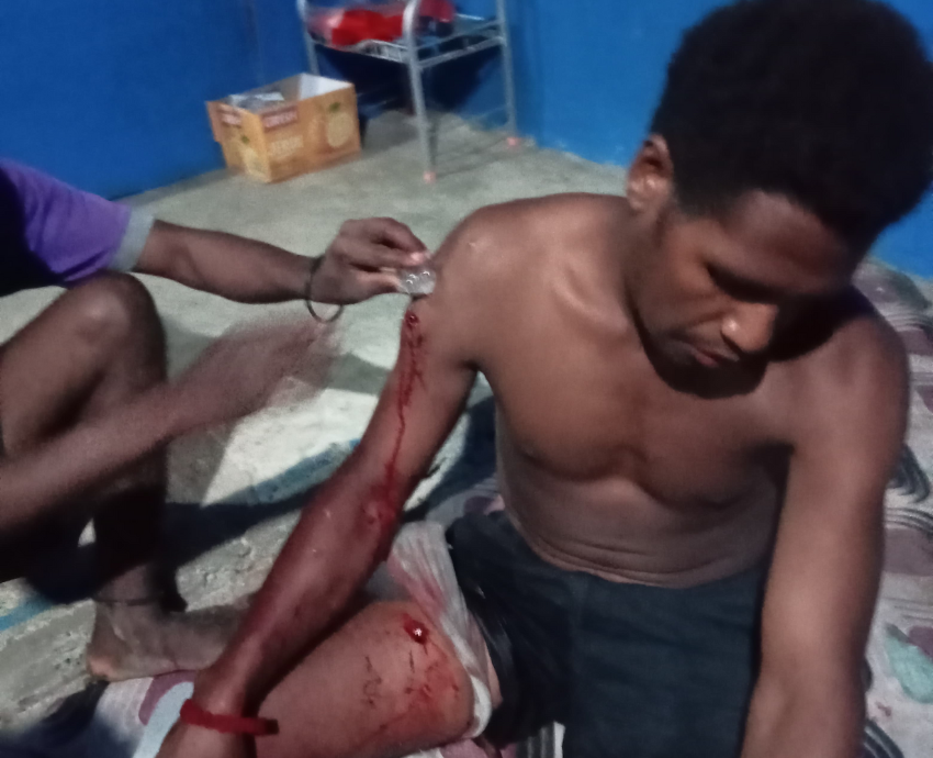 West Papuan shot by police having his wounds treated