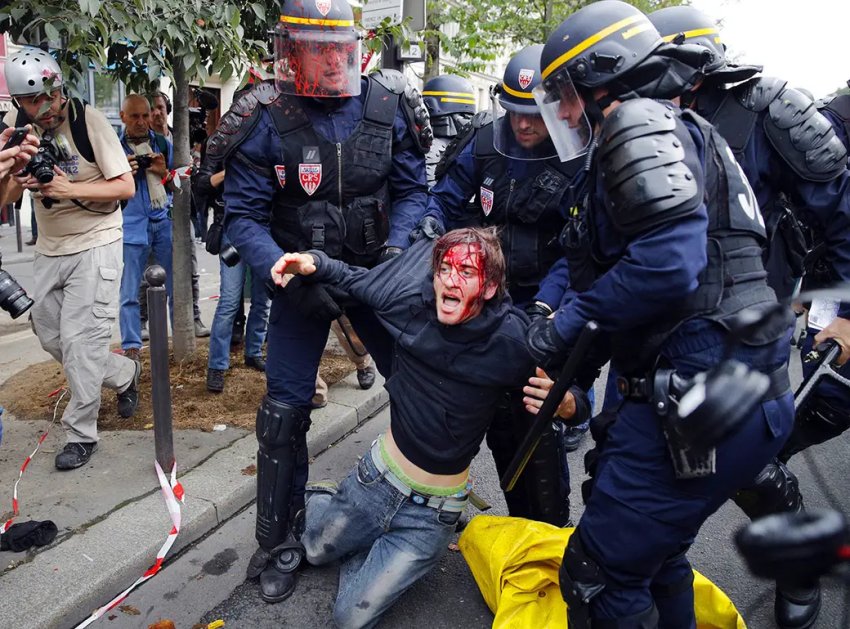 Wounded protester at anti-labour law protests, Paris September 15, 2016.