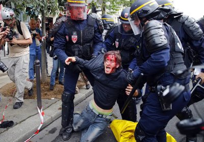 Wounded protester at anti-labour law protests, Paris September 15, 2016.